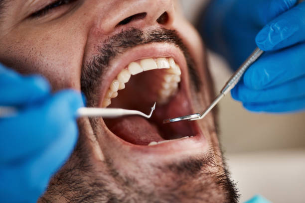 Best Broken Tooth Emergency  in Kaukauna, WI